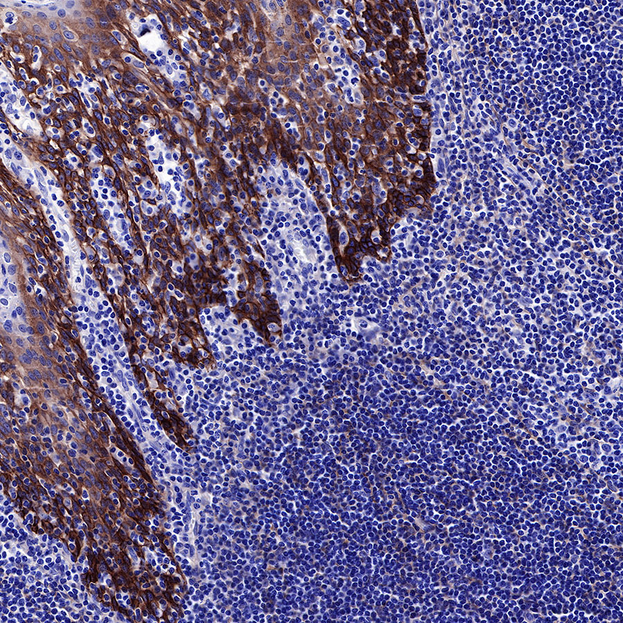 Rabbit anti-EGFR Recombinant Monoclonal Antibody(R110)