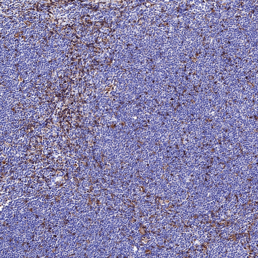 Rabbit anti-CD43 Recombinant Monoclonal Antibody(R101)