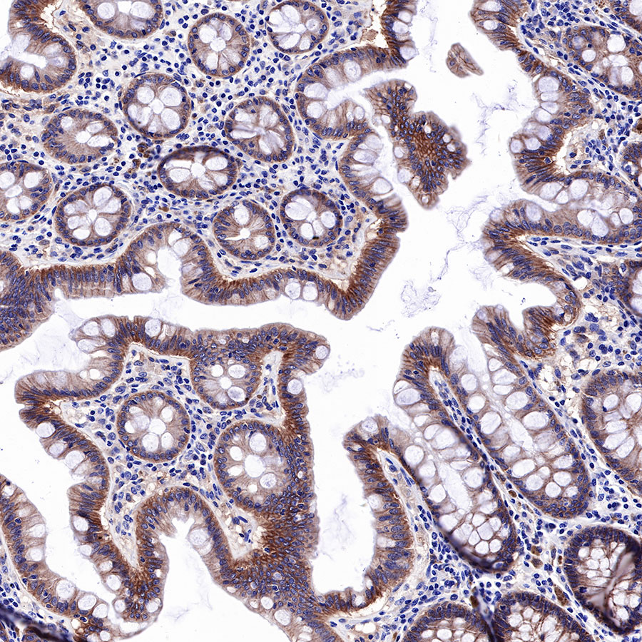 Rabbit anti-EGFR Recombinant Monoclonal Antibody(R110)