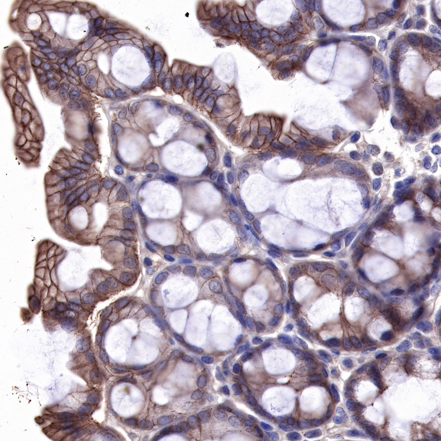 Rabbit anti-EGFR Recombinant Monoclonal Antibody(R110)