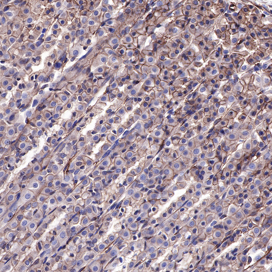 Rabbit anti-EGFR Recombinant Monoclonal Antibody(R110)