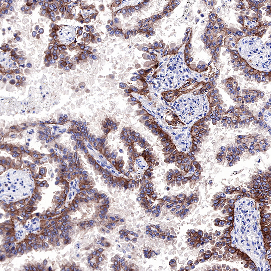 Rabbit anti-EGFR Recombinant Monoclonal Antibody(R110)