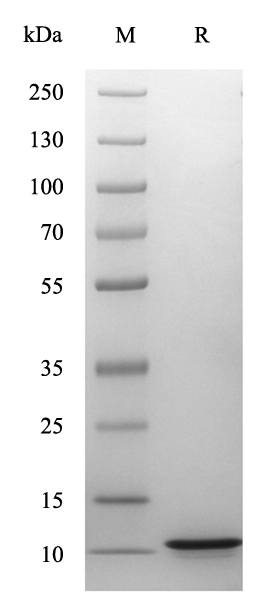 Recombinant Human Tau Protein(His Tag)