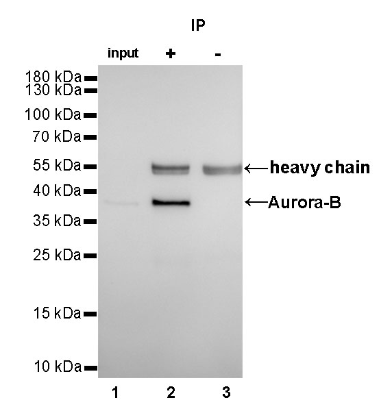 Rabbit anti-Aurora-B Monoclonal Antibody(079-32)