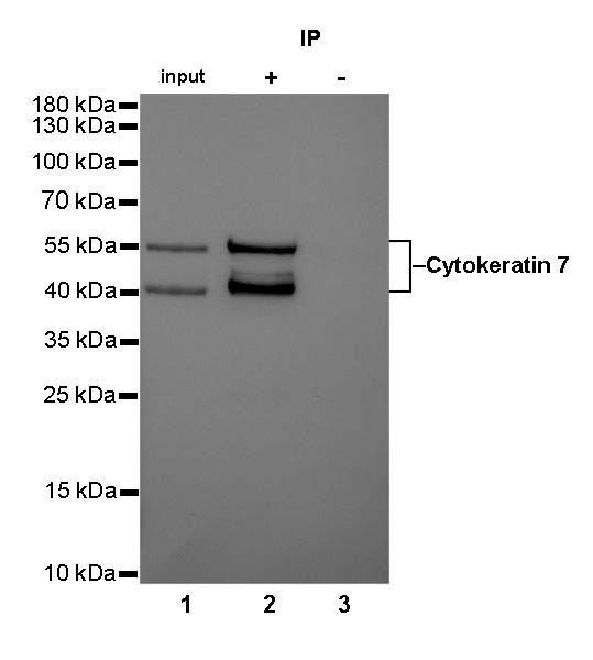 Rabbit anti-CytokeRatin 7 Recombiant Monoclonal Antibody(121-17)