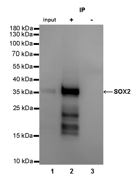 Rabbit anti-SOX2 Recombinant Monoclonal Antibody(066-58)