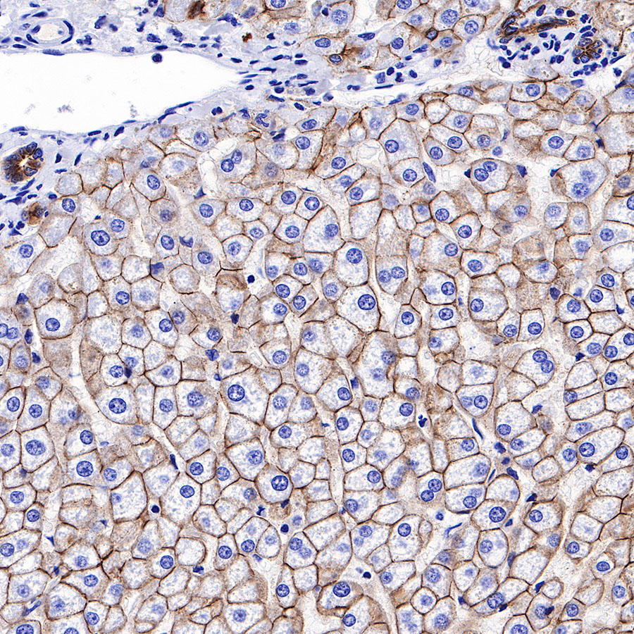 Rabbit anti-E-Cadherin Recombinant Monoclonal Antibody(R088)