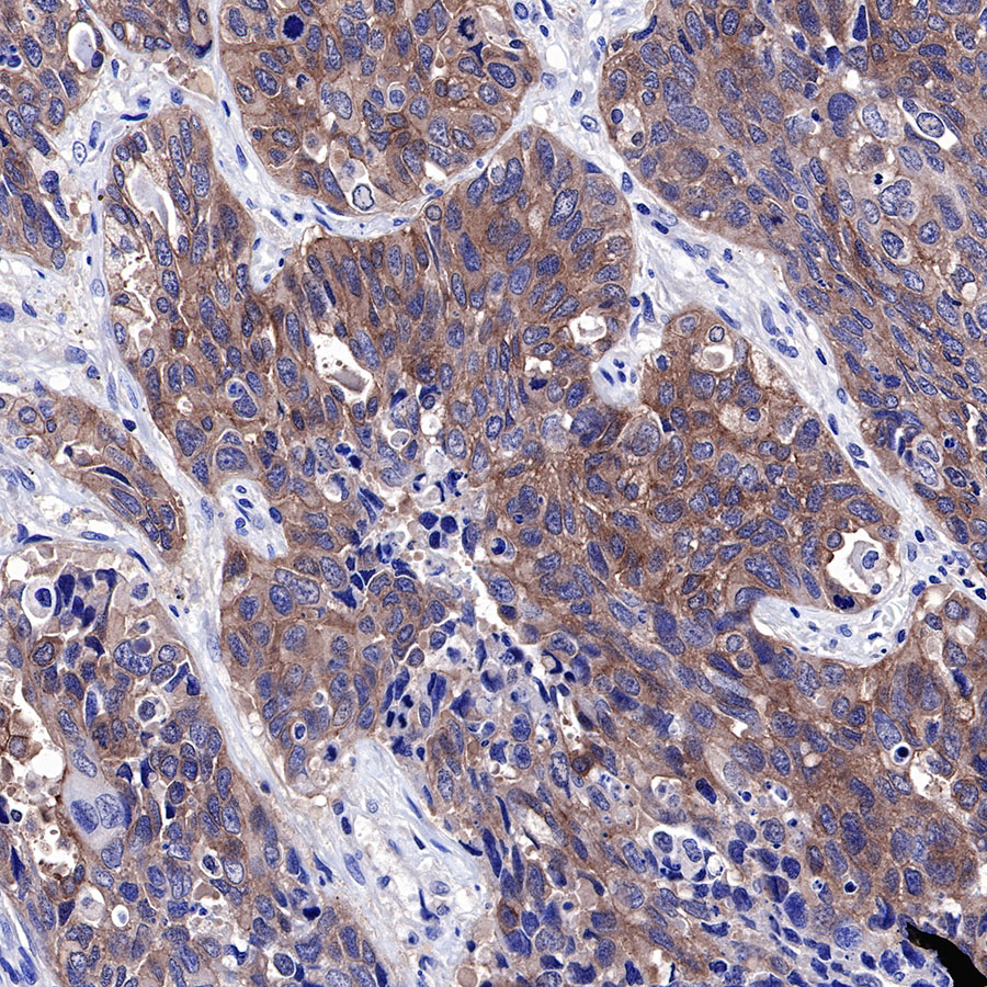 Rabbit anti-c-Met Recombinant Monoclonal Antibody(009-7H0L0)