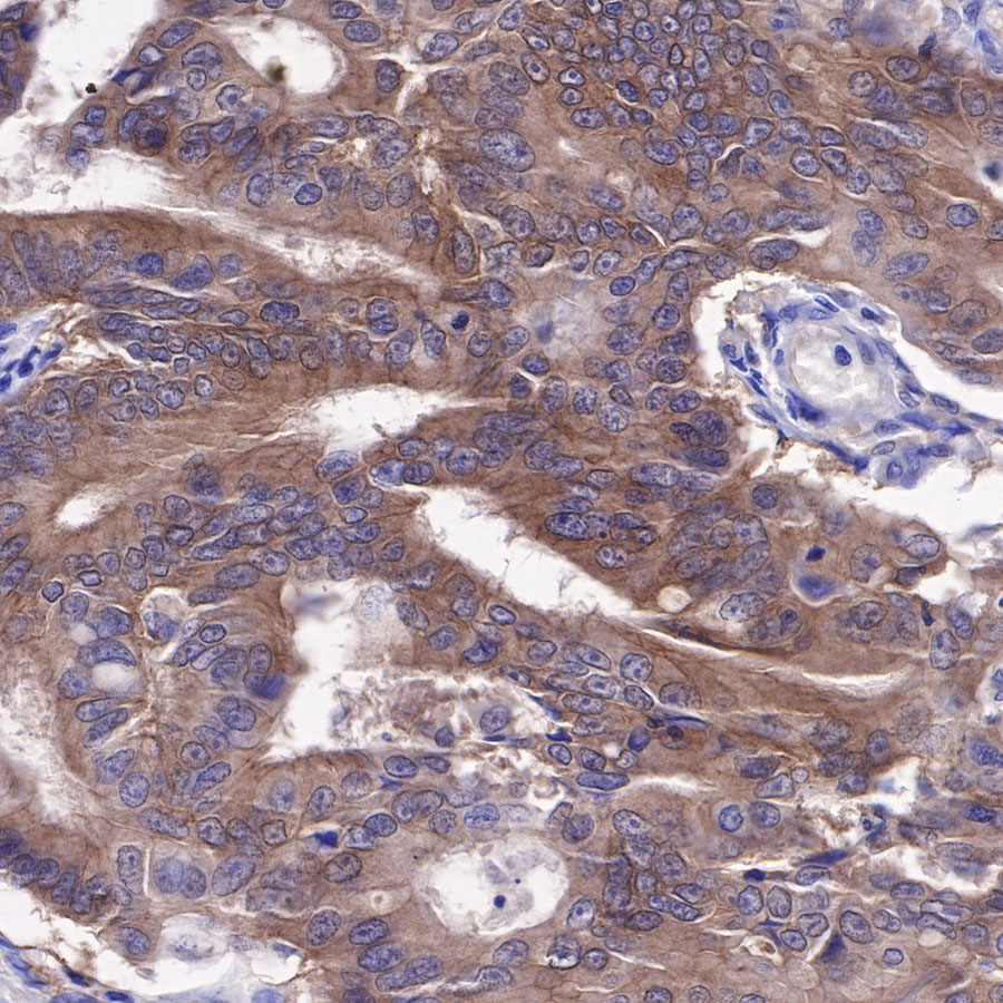 Rabbit anti-c-Met Recombinant Monoclonal Antibody(009-7H0L0)
