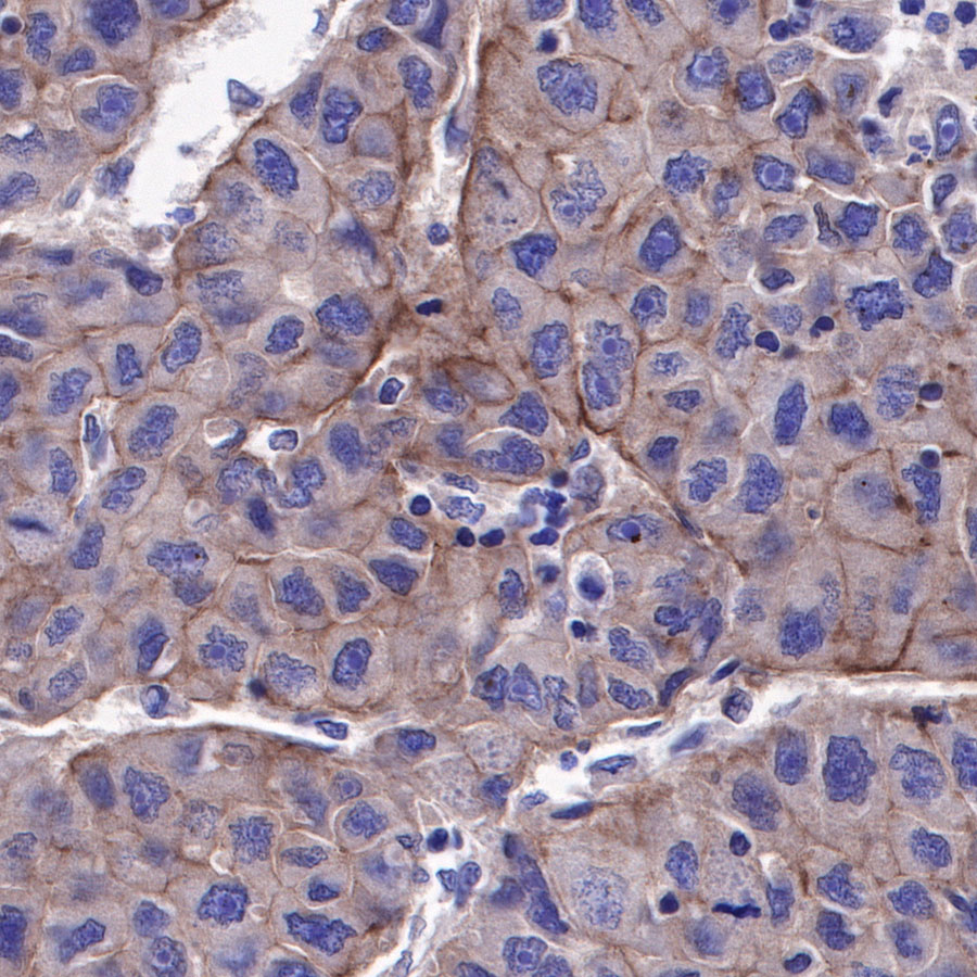 Rabbit anti-c-Met Recombinant Monoclonal Antibody(009-7H0L0)