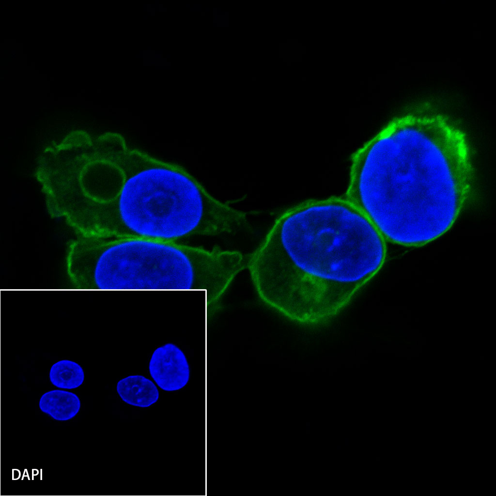 Rabbit anti-EGFR Recombinant Monoclonal Antibody(R110)
