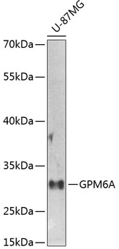 Rabbit anti-GPM6A Polyclonal Antibody
