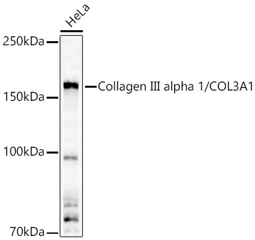 Rabbit anti-COL3A1 Polyclonal Antibody