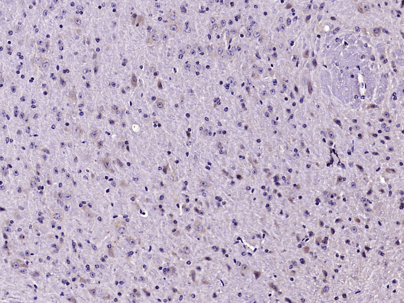 Rabbit anti-MAP1A Polyclonal Antibody