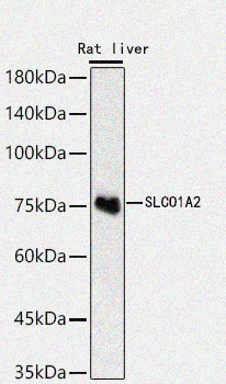 Rabbit anti-SLCO1A2 Polyclonal Antibody