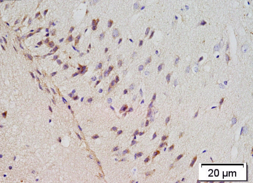 Rabbit Anti Amyloid Precursor Protein Polyclonal Antibody 爱必信 Absin 官网