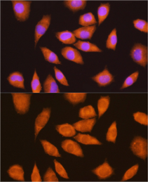 Rabbit anti-LY6E Polyclonal Antibody