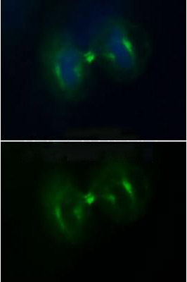 Rabbit anti-β-Tubulin Polyclonal Antibody