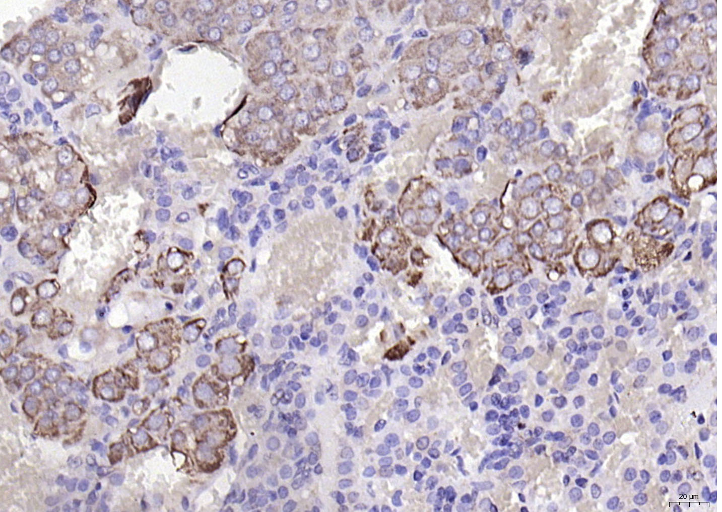 Rabbit anti-CHRNA7 Polyclonal Antibody
