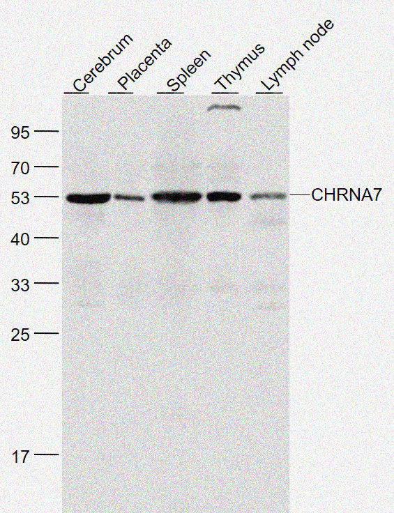 Rabbit anti-CHRNA7 Polyclonal Antibody