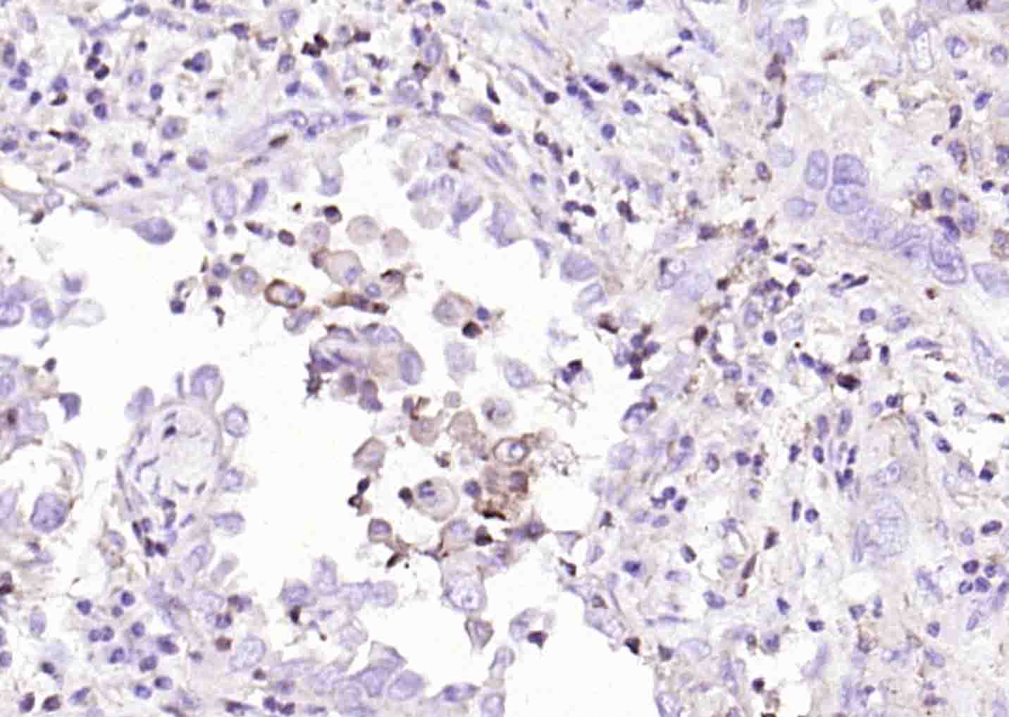 Rabbit anti-PD-L1 Monoclonal Antibody
