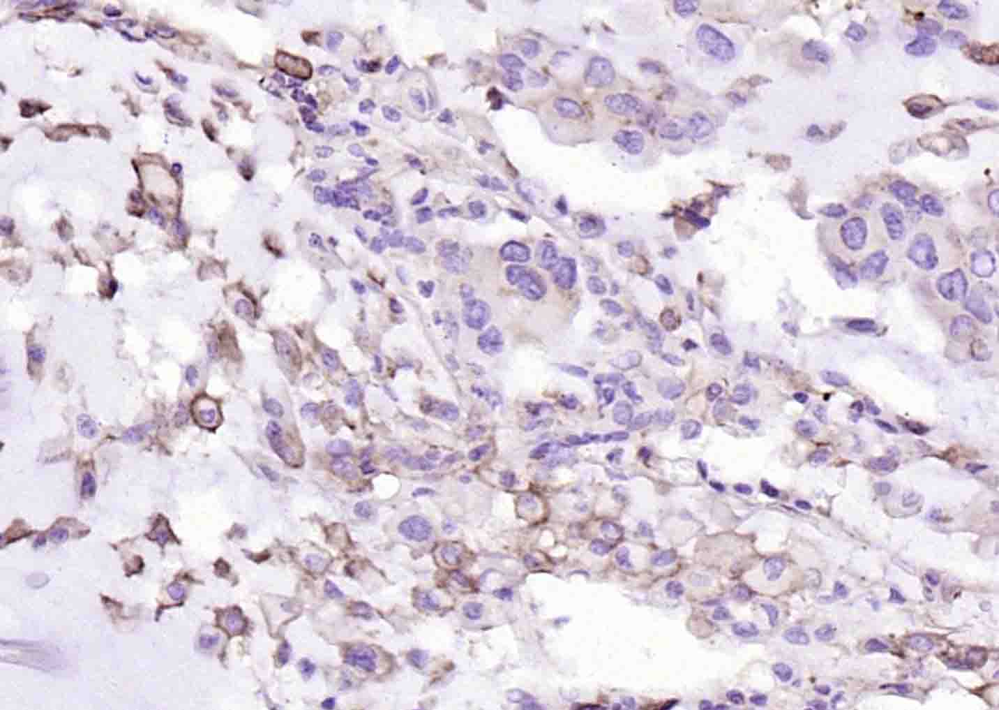 Rabbit anti-PD-L1 Monoclonal Antibody