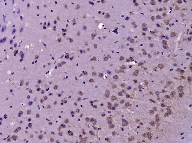 Rabbit anti-Tyrosine Hydroxylase Polyclonal Antibody