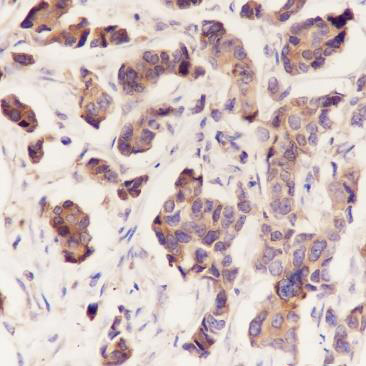 Mouse anti-TGN46 Monoclonal Antibody