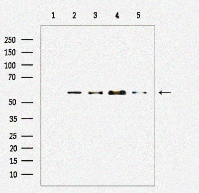 Rabbit anti-Akt Polyclonal Antibody