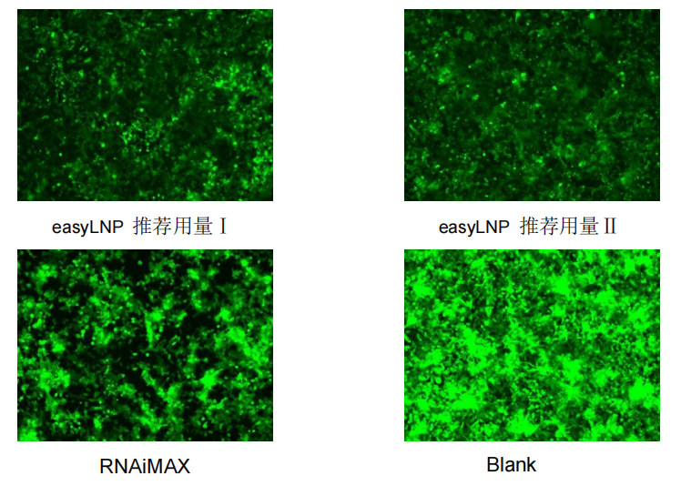 easyLNP™ Plus 通用型RNA细胞转染试剂盒