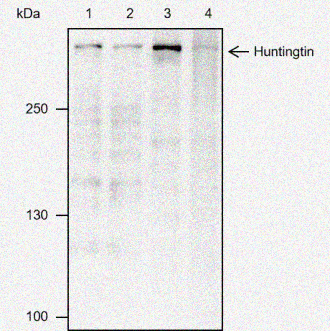 Mouse anti-Huntingtin Monoclonal Antibody(11557)