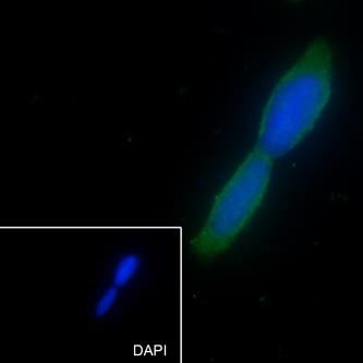 Mouse anti-Huntingtin Monoclonal Antibody(11557)