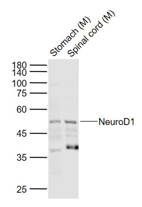Rabbit anti-NeuroD1 Polyclonal Antibody