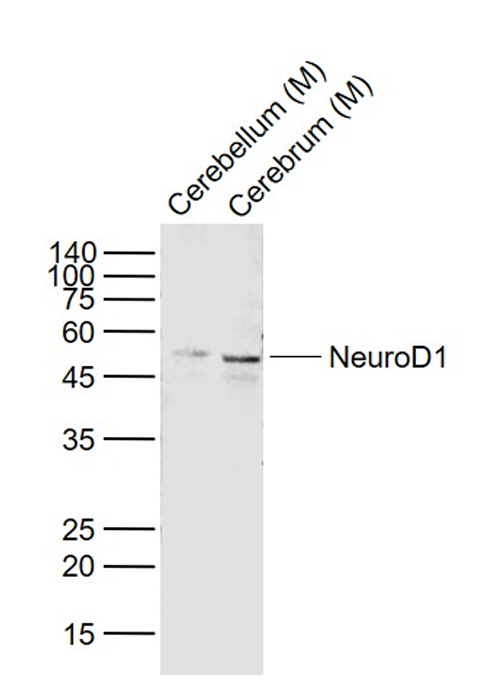 Rabbit anti-NeuroD1 Polyclonal Antibody