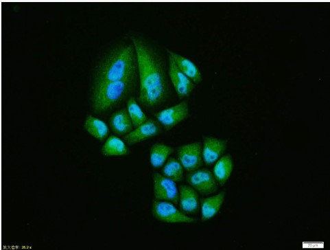 Rabbit anti-HIF-1α Polyclonal Antibody