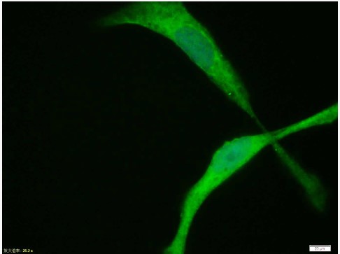 Rabbit anti-HIF-1α Polyclonal Antibody