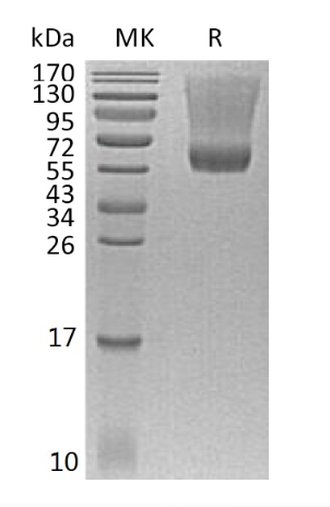 Recombinant Human Decorin (C-6His)
