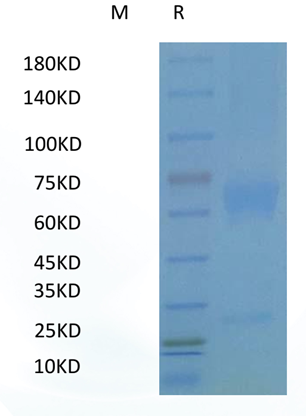 类器官专用Human Wnt-3a Protein