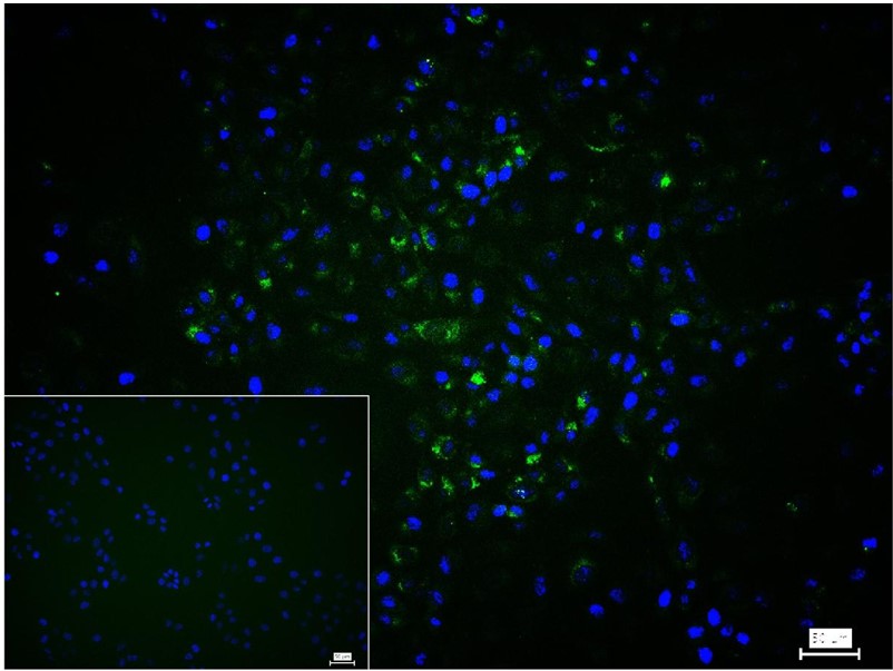 Rabbit anti-Collagen I Polyclonal Antibody