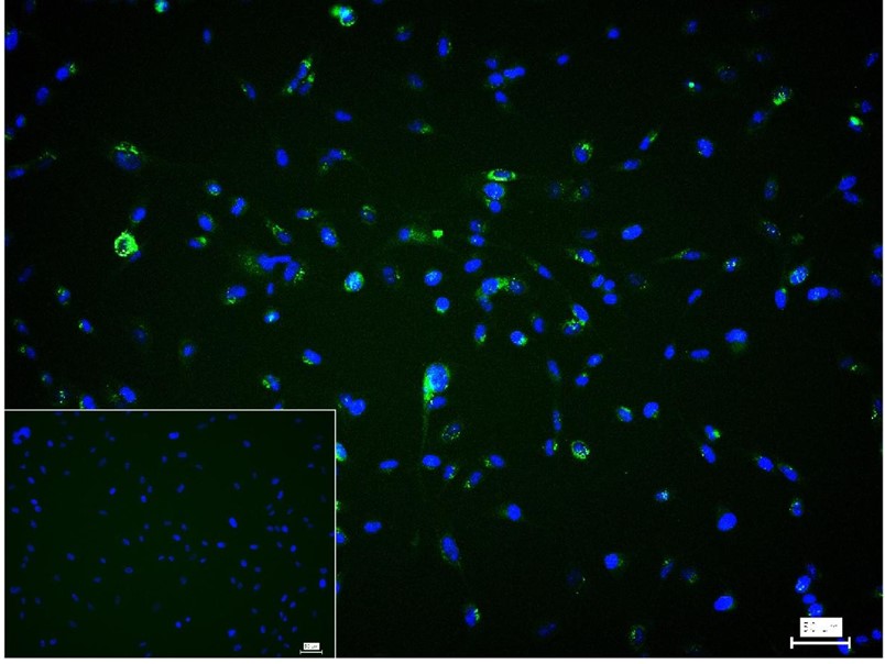 Rabbit anti-Collagen I Polyclonal Antibody