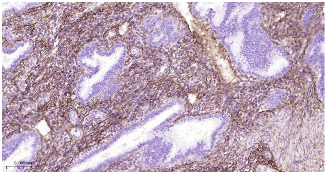 Rabbit anti-Collagen I Polyclonal Antibody