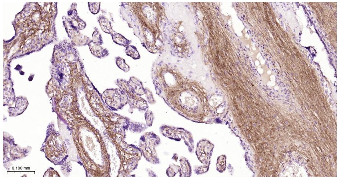 Rabbit anti-Collagen I Polyclonal Antibody