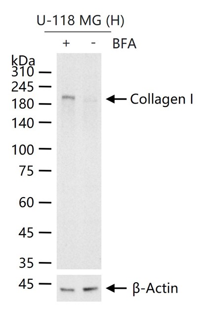 Rabbit anti-Collagen I Polyclonal Antibody