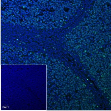 Mouse anti-Ki67 Monoclonal Antibody(606-33)