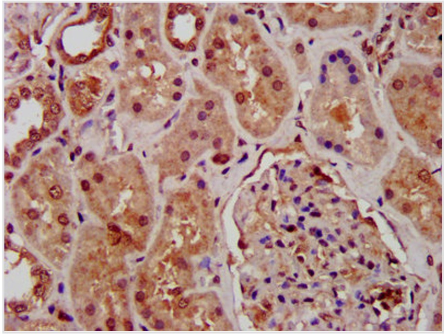 Rabbit anti-SUZ12 Polyclonal Antibody