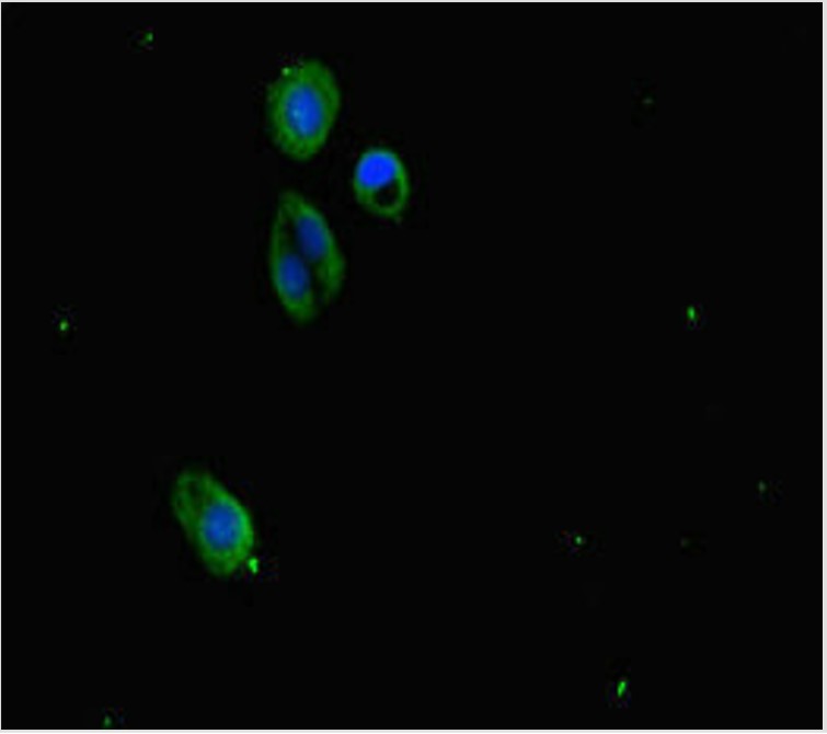 Rabbit anti-SUZ12 Polyclonal Antibody