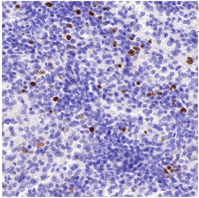 Mouse anti-Ki67 Monoclonal Antibody(606-33)