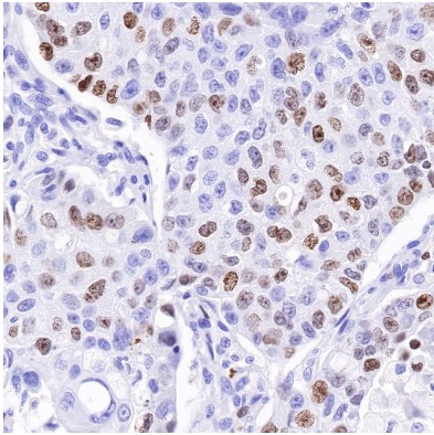 Mouse anti-Ki67 Monoclonal Antibody(606-33)
