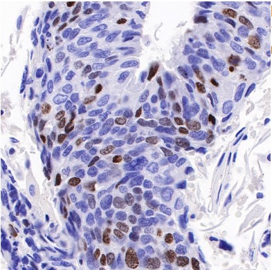 Mouse anti-Ki67 Monoclonal Antibody(606-33)