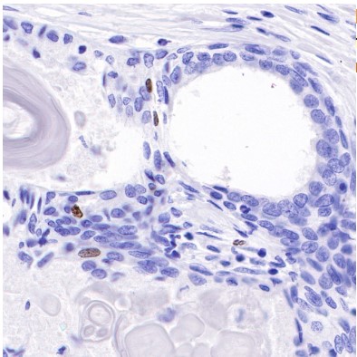 Mouse anti-Ki67 Monoclonal Antibody(606-33)